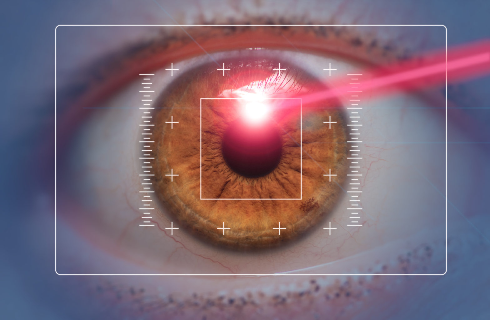 Chirurgie de la basse vision au laser d'un oeil couleur noisette